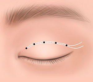 STEP03