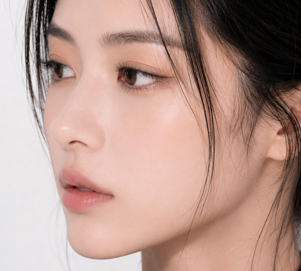 鼻翼リフト