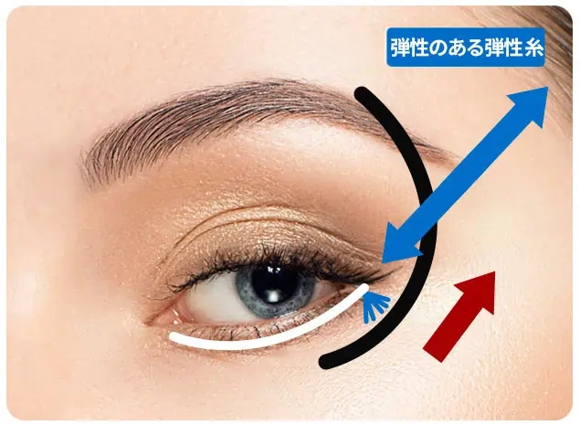 Dr.リターニングフォックスアイリフト：弾性のあるエラスティクム糸を使用