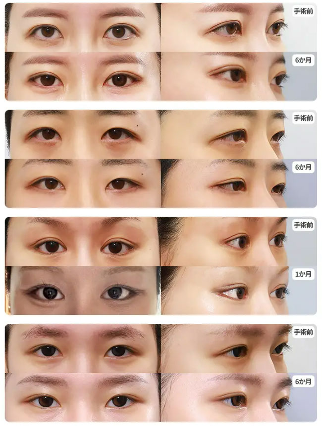 fox-eye-case