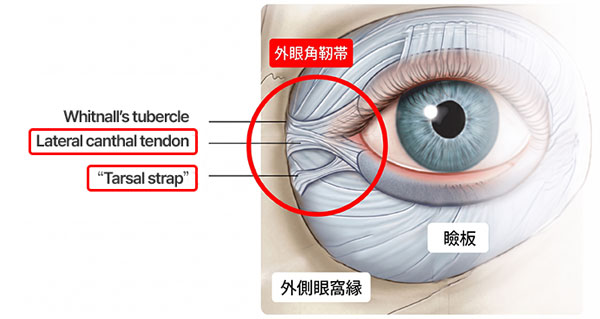 外眼角靭帯とWhitnall's tubercle、瞼板の解剖図