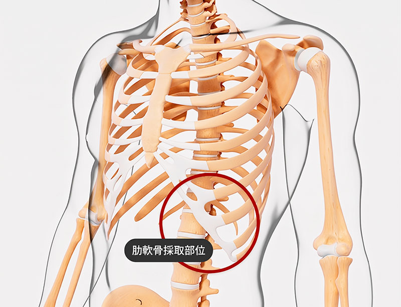 肋軟骨採取部位